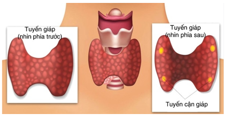MỘT SỐ BIẾN CHỨNG SAU PHẪU THUẬT CẮT TUYẾN GIÁP TRONG ĐIỀU TRỊ UNG THƯ TUYẾN GIÁP