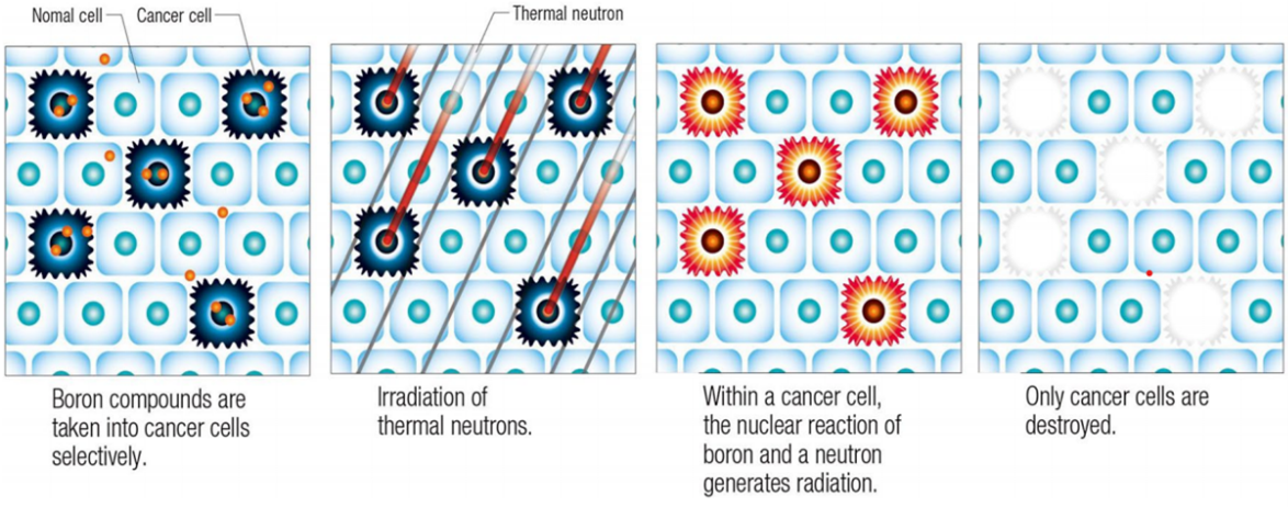 Xạ trị kích hoạt Boron bằng Neutron (Boron Neutron Capture Therapy: BNCT) và vai trò của PET/CT ứng dụng trong điều trị u nguyên bào thần kinh