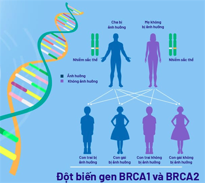 Cập nhật chỉ định xét nghiệm BRCA trong ung thư vú, buồng trứng, tụy, tuyến tiền liệt năm 2025