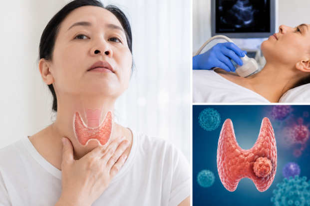 TIẾP CẬN CHẨN ĐOÁN VÀ QUẢN LÝ BỆNH NHÂN CÓ NHÂN TUYẾN GIÁP